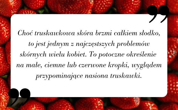 Truskawkowa skóra na nogach - co to jest?